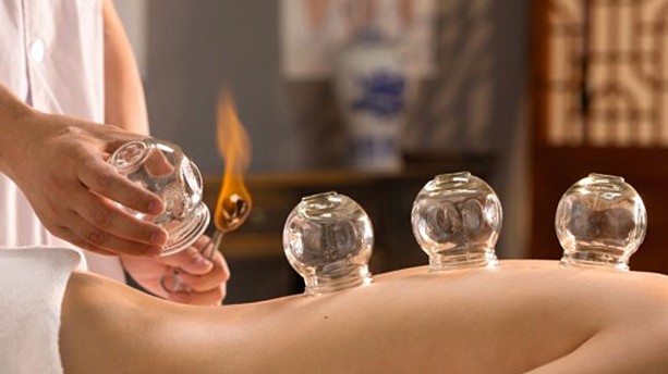 Giác hơi - phương thức trị liệu không dùng thuốc trong Y học cổ truyền