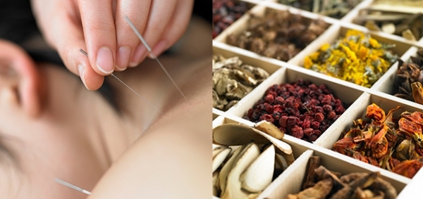 Thảo dược trong điều trị bằng châm cứu: Giải pháp kết hợp hoàn hảo cho sức khỏe