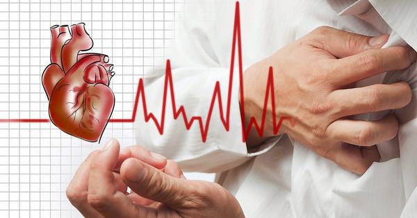 Dấu hiệu điển hình của cơn nhồi máu cơ tim