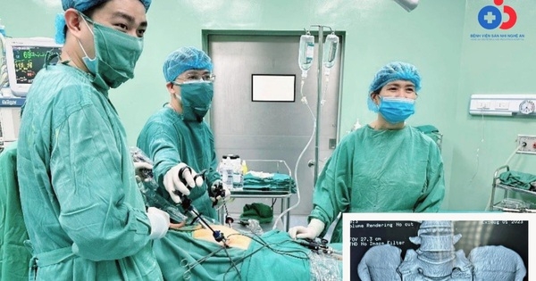 Hai phụ nữ bị vòng tránh thai đâm xuyên thành tử cung, bác sĩ chỉ rõ triệu chứng dễ nhận biết