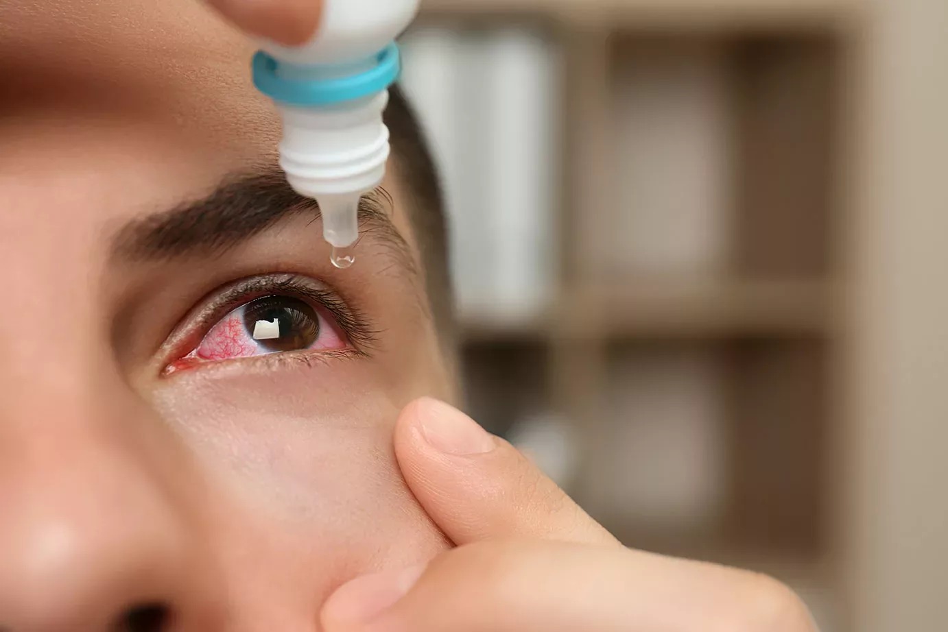 Cách dùng thuốc trị đau mắt đỏ đúng và hiệu quả nhất - Ảnh 4.