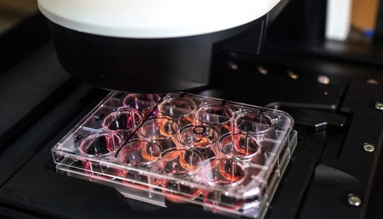 "Vaccine ngừa ung thư của Nga đã sẵn sàng để sử dụng"